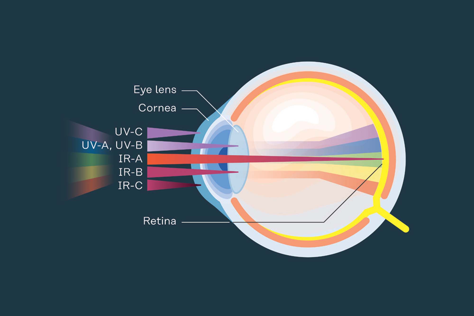 You’re suffering from arc eye, but what should you do?